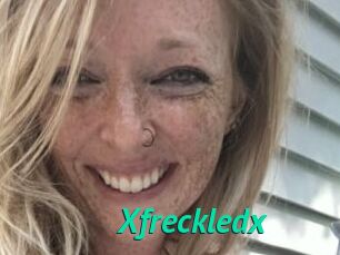 Xfreckledx